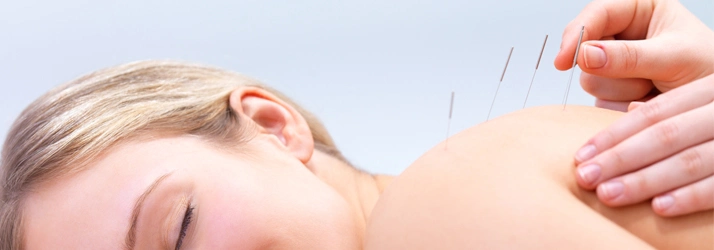 Chiropractic Lombard IL Acupuncture